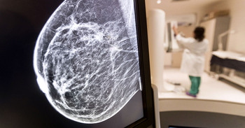 Cribado de cáncer de mama para 8.000 burgalesas más